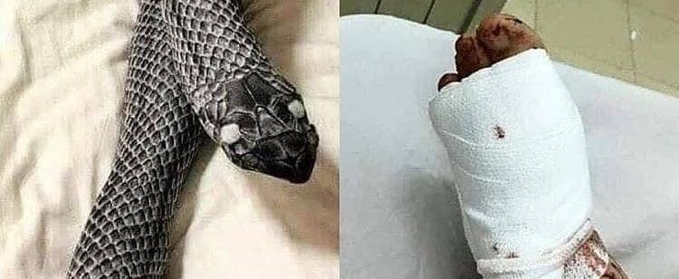В Казани муж сломал ногу жене из-за пижамы в виде змеи